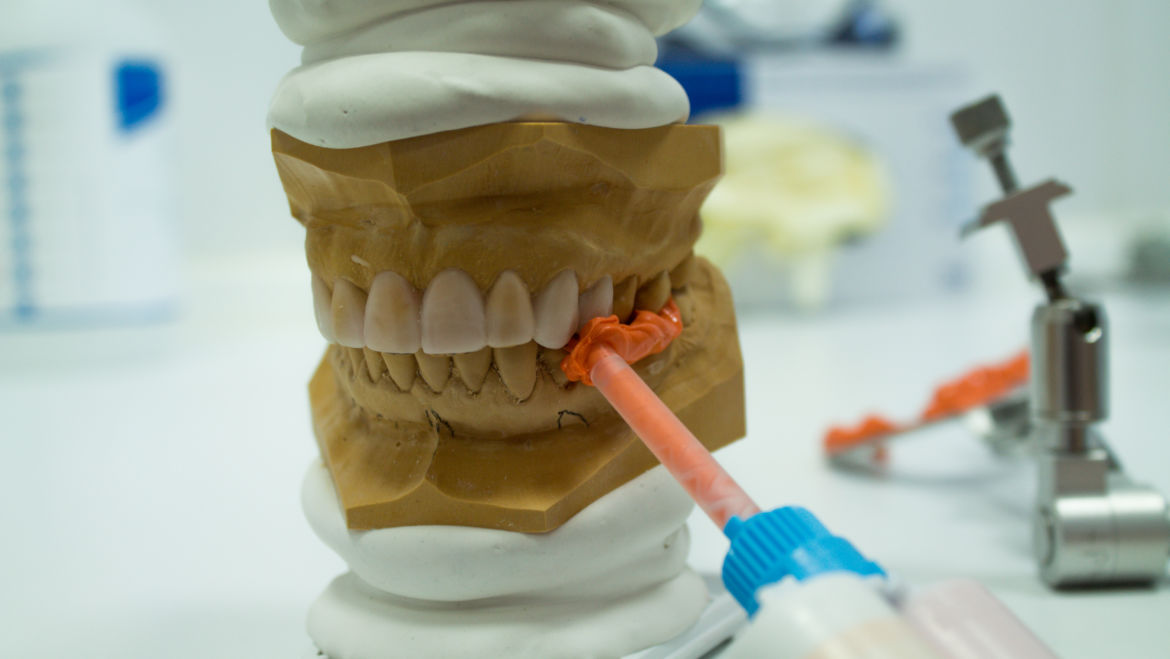 Zahnverlust: Ein toter Zahn ist kein großes Unglück